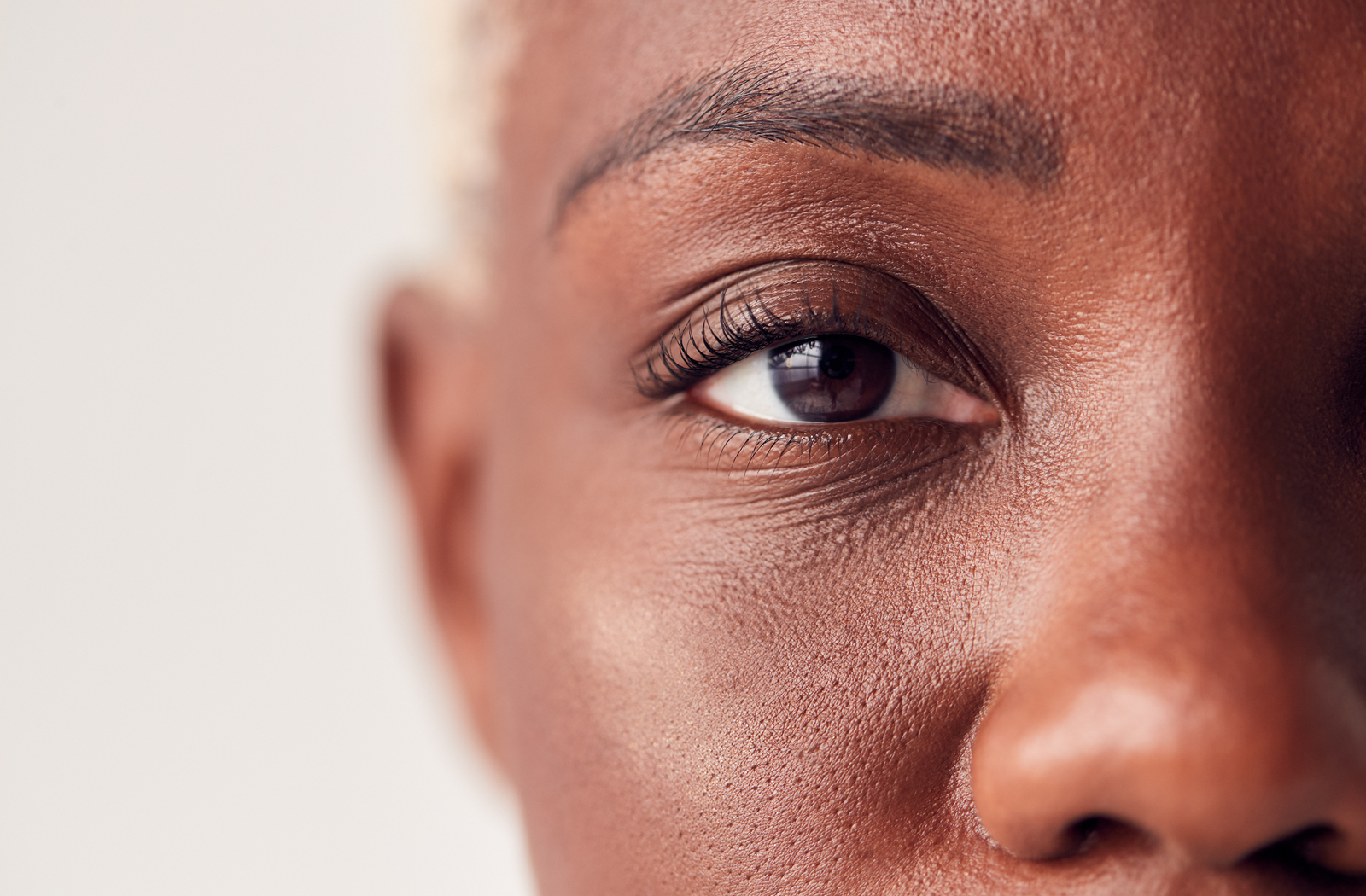 Eyelid Lumps And Bumps